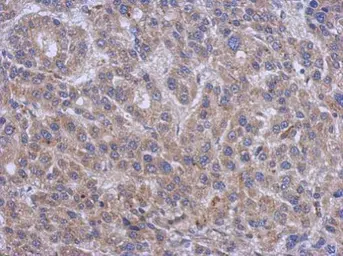 Anti-Serine palmitoyltransferase 2 antibody [N1N3] used in IHC (Paraffin sections) (IHC-P). GTX118192