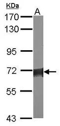 Anti-Serine palmitoyltransferase 2 antibody [N1N3] used in Western Blot (WB). GTX118192
