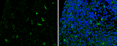 Anti-SLIT2 antibody used in IHC (Paraffin sections) (IHC-P). GTX118220