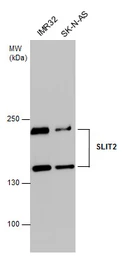 Anti-SLIT2 antibody used in Western Blot (WB). GTX118220