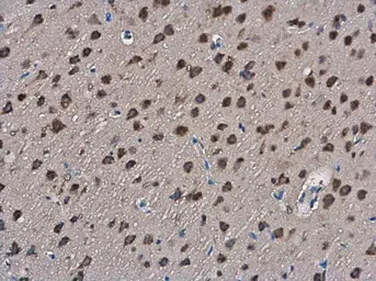 Anti-SLIT2 antibody used in IHC (Paraffin sections) (IHC-P). GTX118220