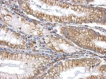 Anti-SLIT2 antibody used in IHC (Paraffin sections) (IHC-P). GTX118220