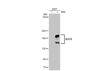 Anti-SLIT2 antibody used in Western Blot (WB). GTX118220