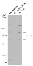 Anti-SLIT2 antibody used in Western Blot (WB). GTX118220