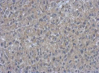 Anti-ARMC1 antibody [N1C2] used in IHC (Paraffin sections) (IHC-P). GTX118227