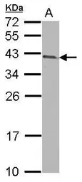 Anti-ARMC1 antibody [N1C2] used in Western Blot (WB). GTX118227