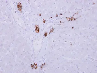 Anti-ARMC1 antibody [N1C2] used in IHC (Paraffin sections) (IHC-P). GTX118227