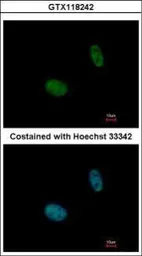 Anti-NANS antibody used in Immunocytochemistry/ Immunofluorescence (ICC/IF). GTX118242
