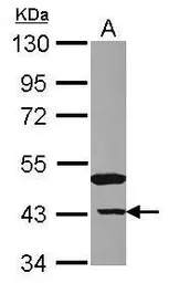 Anti-NANS antibody used in Western Blot (WB). GTX118242