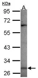 Anti-MAGEA3 antibody [N2C3] used in Western Blot (WB). GTX118244