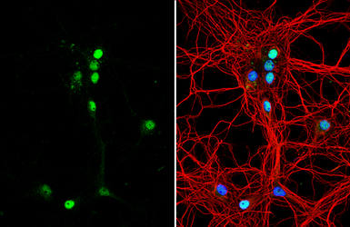 Anti-TNR antibody [C1C2], Internal used in Immunocytochemistry/ Immunofluorescence (ICC/IF). GTX118246