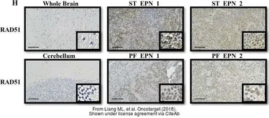 Anti-Rad51 antibody used in IHC (Frozen sections) (IHC-Fr). GTX118249