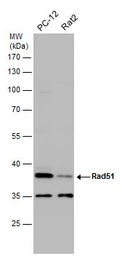 Anti-Rad51 antibody used in Western Blot (WB). GTX118249