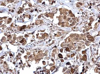 Anti-Rad51 antibody used in IHC (Paraffin sections) (IHC-P). GTX118249