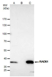 Anti-Rad51 antibody used in Immunoprecipitation (IP). GTX118249