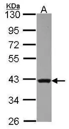 Anti-Rad51 antibody used in Western Blot (WB). GTX118249