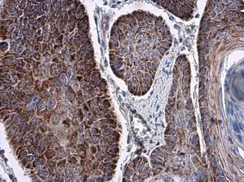 Anti-RNF212 antibody used in IHC (Paraffin sections) (IHC-P). GTX118251