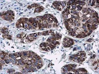 Anti-RNF212 antibody used in IHC (Paraffin sections) (IHC-P). GTX118251