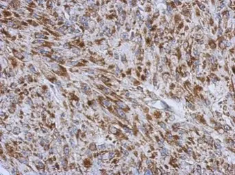Anti-RNF212 antibody used in IHC (Paraffin sections) (IHC-P). GTX118251