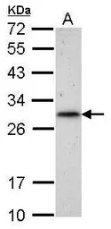 Anti-RNF212 antibody used in Western Blot (WB). GTX118251