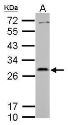 Anti-PAFAH1B2 antibody used in Western Blot (WB). GTX118289