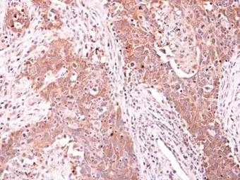 Anti-ARPC1A antibody used in IHC (Paraffin sections) (IHC-P). GTX118302