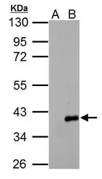 Anti-ARPC1A antibody used in Western Blot (WB). GTX118302