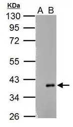 Anti-ARPC1A antibody used in Western Blot (WB). GTX118303