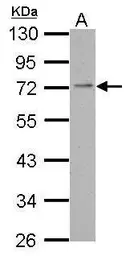 Anti-PDE4C antibody [N3C2], Internal used in Western Blot (WB). GTX118307