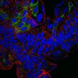 Anti-ATP6V0D1 antibody used in Immunohistochemistry (IHC). GTX118317