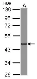 Anti-ATP6V0D1 antibody used in Western Blot (WB). GTX118317