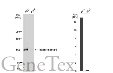 Anti-Integrin beta 6 antibody used in Western Blot (WB). GTX118323
