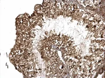 Anti-Integrin beta 6 antibody used in IHC (Paraffin sections) (IHC-P). GTX118323