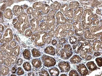 Anti-Integrin beta 6 antibody used in IHC (Paraffin sections) (IHC-P). GTX118323