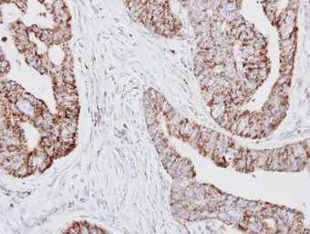 Anti-HADH antibody used in IHC (Paraffin sections) (IHC-P). GTX118325