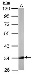 Anti-HADH antibody used in Western Blot (WB). GTX118325