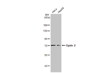 Anti-Epsin 2 antibody [N1C1] used in Western Blot (WB). GTX118330