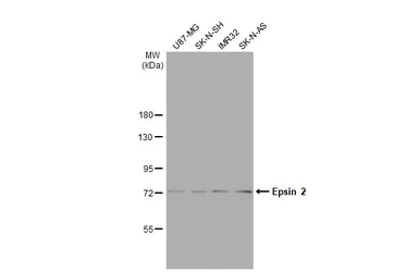 Anti-Epsin 2 antibody [N1C1] used in Western Blot (WB). GTX118330