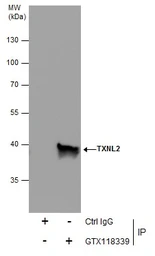 Anti-TXNL2 antibody [N2C3] used in Immunoprecipitation (IP). GTX118339