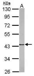 Anti-TXNL2 antibody [N2C3] used in Western Blot (WB). GTX118339