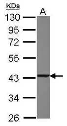 Anti-TXNL2 antibody [N2C3] used in Western Blot (WB). GTX118339