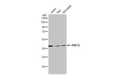 Anti-PAICS antibody [N1C1] used in Western Blot (WB). GTX118341