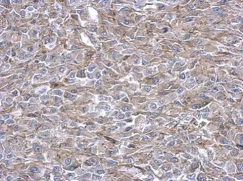 Anti-PAICS antibody [N1C1] used in IHC (Paraffin sections) (IHC-P). GTX118341
