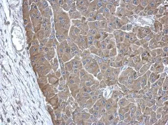 Anti-PAICS antibody [N1C1] used in IHC (Paraffin sections) (IHC-P). GTX118341