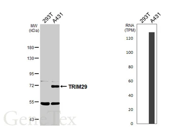 Anti-TRIM29 antibody [N3C3] used in Western Blot (WB). GTX118367