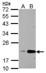 Anti-Cyclophilin B antibody used in Western Blot (WB). GTX118372