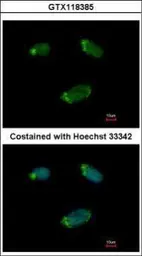 Anti-G protein alpha 16 antibody used in Immunocytochemistry/ Immunofluorescence (ICC/IF). GTX118385