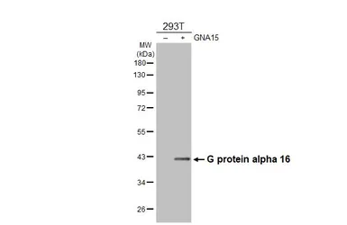 Anti-G protein alpha 16 antibody used in Western Blot (WB). GTX118385