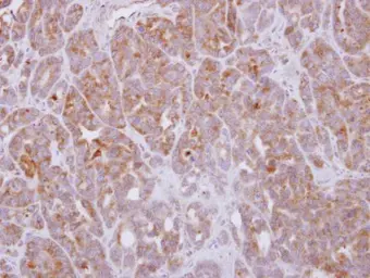 Anti-G protein alpha 16 antibody used in IHC (Paraffin sections) (IHC-P). GTX118385