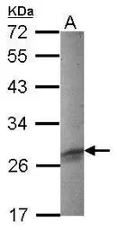 Anti-FHL3 antibody [N1C3-2] used in Western Blot (WB). GTX118404